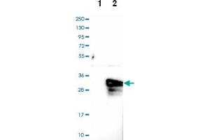 Western blot analysis of Lane 1: Negative control (vector only transfected HEK293T lysate), Lane 2: Over-expression lysate (Co-expressed with a C-terminal myc-DDK tag (~3. (ASB9 抗体)