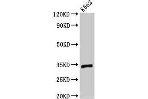 Western Blot Positive WB detected in: K562 whole cell lysate All lanes: TMEM177 antibody at 3 μg/mL Secondary Goat polyclonal to rabbit IgG at 1/50000 dilution Predicted band size: 34 kDa Observed band size: 34 kDa (TMEM177 抗体  (AA 219-311))