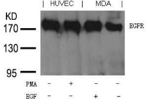 Image no. 1 for anti-Epidermal Growth Factor Receptor (EGFR) (Tyr1197) antibody (ABIN401656) (EGFR 抗体  (Tyr1197))