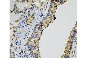 Immunohistochemistry of paraffin-embedded Mouse lung using DNM2 Polyclonal Antibody (DNM2 抗体)