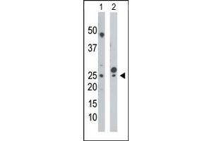 Western Blotting (WB) image for anti-Cytidine Monophosphate (UMP-CMP) Kinase 1, Cytosolic (CMPK1) (N-Term) antibody (ABIN360613) (Cytidine Monophosphate (UMP-CMP) Kinase 1, Cytosolic (CMPK1) (N-Term) 抗体)