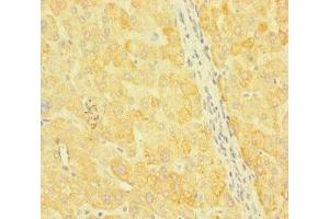 Immunohistochemistry of paraffin-embedded human liver tissue using ABIN7170352 at dilution of 1:100 (SNX14 抗体  (AA 601-893))