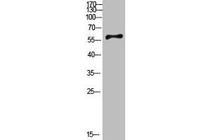 Western Blotting (WB) image for anti-Cytochrome P450, Family 26, Subfamily B, Polypeptide 1 (CYP26B1) (AA 391-440) antibody (ABIN7189495)