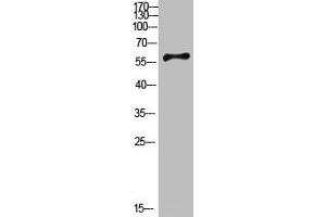 Western Blot analysis of mouse-brain cells using Antibody diluted at 800. (CYP26B1 抗体  (AA 391-440))