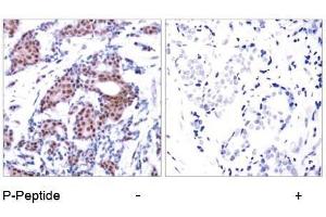 Image no. 2 for anti-ELK1, Member of ETS Oncogene Family (ELK1) (pSer383) antibody (ABIN196614) (ELK1 抗体  (pSer383))