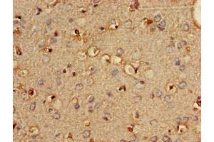 Immunohistochemistry of paraffin-embedded human brain tissue using ABIN7163337 at dilution of 1:100 (PLD3 抗体  (AA 70-176))