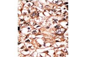 Image no. 1 for anti-Tumor Necrosis Factor Receptor Superfamily, Member 1A (TNFRSF1A) (pSer274) antibody (ABIN358242) (TNFRSF1A 抗体  (pSer274))