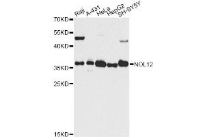 Western blot analysis of extracts of various cell lines, using NOL12 antibody. (NOL12 抗体)