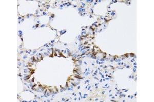 Immunohistochemistry of paraffin-embedded Rat lung using NAA10 Polyclonal Antibody at dilution of 1:100 (40x lens). (NAA10 抗体)
