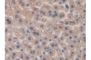 IHC-P analysis of Mouse Liver Tissue, with DAB staining. (CCL4 抗体  (AA 24-92))