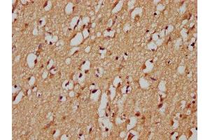 IHC image of ABIN7148390 diluted at 1:200 and staining in paraffin-embedded human brain tissue performed on a Leica BondTM system. (RHBDF1 抗体  (AA 132-221))