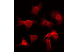 ABIN6272311 staining Hela by IF/ICC. (GZMH 抗体)