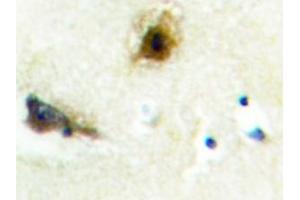 Image no. 1 for anti-Phosphofructokinase, Liver (PFKL) antibody (ABIN272176) (PFKL 抗体)
