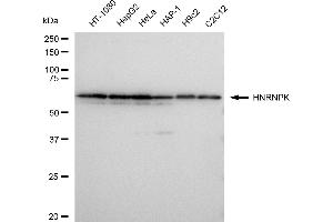 Western blotting analysis using HNRNPK antibody (ABIN7798900). (Recombinant HNRNPK 抗体)