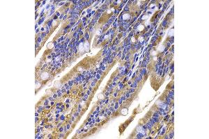 Immunohistochemistry of paraffin-embedded mouse ileum using HDGFRP2 antibody at dilution of 1:100 (x400 lens). (HDGFRP2 抗体)