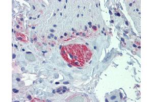 Small intestine, myenteric plexus (TUBB2A 抗体  (Middle Region))