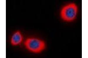 Immunofluorescent analysis of STMN1 (pS38) staining in MCF7 cells. (Stathmin 1 抗体  (N-Term, pSer38))