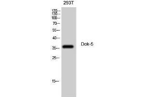 Western Blotting (WB) image for anti-Docking Protein 5 (DOK5) (Internal Region) antibody (ABIN3174809) (DOK5 抗体  (Internal Region))