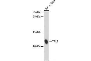 Western blot analysis of extracts of Rat spleen using TAL2 Polyclonal Antibody at dilution of 1:1000.