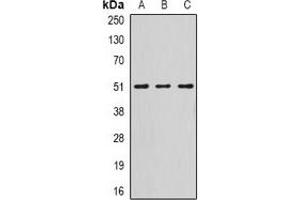 Western blot analysis of Serpin A10 expression in HepG2 (A), mouse liver (B), rat liver (C) whole cell lysates. (SERPINA10 抗体)