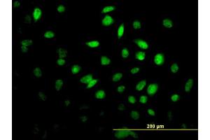 Immunofluorescence of monoclonal antibody to FOXF2 on HeLa cell. (FOXF2 抗体  (AA 346-443))