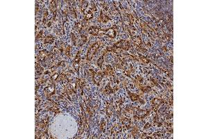 IHC analysis of SBP/SELENBP1 using anti-SBP/SELENBP1 antibody (ABIN7600755). (SELENBP1 抗体  (AA 23-462))