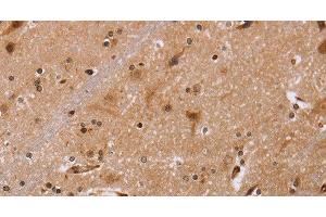 Immunohistochemistry of paraffin-embedded Human brain tissue using FBP2 Polyclonal Antibody at dilution 1:40 (FBP2 抗体)