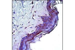 CD1A Antibody (Center) (ABIN657461 and ABIN2846488) immunohistochemistry analysis in formalin fixed and paraffin embedded human skin tissue followed by peroxidase conjugation of the secondary antibody and DAB staining. (CD1a 抗体  (AA 75-104))