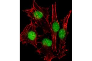 Immunofluorescent analysis of 4 % paraformaldehyde-fixed, 0. (SUMO1 抗体)