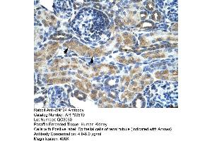 Human kidney (ZNF24 抗体  (Middle Region))