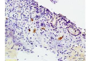 Immunohistochemistry (Paraffin-embedded Sections) (IHC (p)) image for anti-Chemokine (C-C Motif) Receptor 3 (CCR3) (AA 251-355) antibody (ABIN738651)