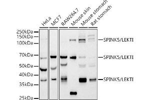 Western Blotting (WB) image for anti-serine Peptidase Inhibitor, Kazal Type 5 (SPINK5) antibody (ABIN7270212)