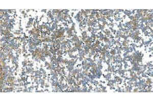 IHC analysis of DR6/TNFRSF21 using anti-DR6/TNFRSF21 antibody (ABIN7603008).