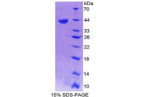 SDS-PAGE (SDS) image for Chemokine (C-X-C Motif) Ligand 14 (CXCL14) (AA 35-111) protein (His tag,GST tag) (ABIN2122511)