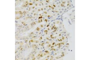 Immunohistochemistry (Paraffin-embedded Sections) (IHC (p)) image for anti-Nuclear Autoantigenic Sperm Protein (Histone-Binding) (NASP) (AA 180-449) antibody (ABIN6144374)