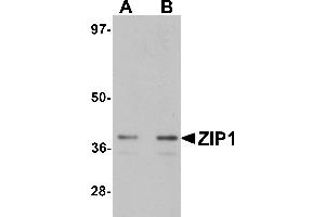 Western Blotting (WB) image for anti-Solute Carrier Family 39 (Zinc Transporter), Member 1 (SLC39A1) (N-Term) antibody (ABIN1031679) (SLC39A1 抗体  (N-Term))