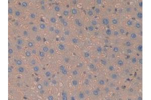 DAB staining on IHC-P; Samples: Rat Liver Tissue (Haptoglobin 抗体  (AA 70-332))