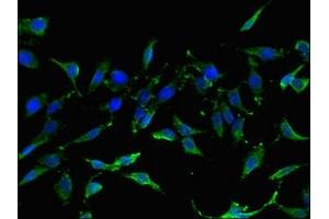 Immunofluorescent analysis of Hela cells using ABIN7153207 at dilution of 1:100 and Alexa Fluor 488-congugated AffiniPure Goat Anti-Rabbit IgG(H+L) (TIGAR 抗体  (AA 24-188))