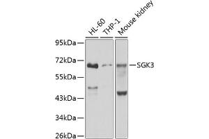 Western blot analysis of extracts of various cell lines, using SGK3 antibody (ABIN6132066, ABIN6147709, ABIN6147710 and ABIN6223495) at 1:1000 dilution. (SGK3 抗体  (AA 1-150))