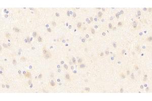 Detection of NOS1 in Rat Cerebrum Tissue using Polyclonal Antibody to Nitric Oxide Synthase 1, Neuronal (NOS1) (NOS1 抗体  (AA 9-136))