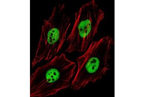 Fluorescent image of Hela cells stained with (Mouse) Trim24 Antibody (C-term) (ABIN6244019 and ABIN6577664).