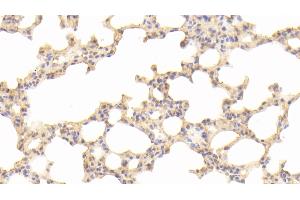 Immunohistochemistry (IHC) image for anti-Peptidylprolyl Isomerase A (Cyclophilin A) (PPIA) (AA 2-164) antibody (ABIN7432964)