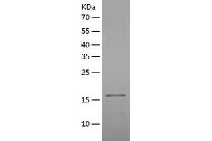 Western Blotting (WB) image for Tumor Necrosis Factor Receptor Superfamily, Member 11a, NFKB Activator (TNFRSF11A) (AA 28-202) protein (His tag) (ABIN7125546)