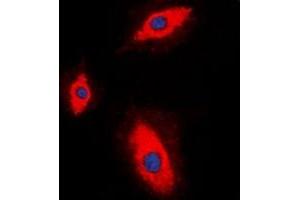 Immunofluorescent analysis of Granzyme A staining in HepG2 cells. (GZMA 抗体)