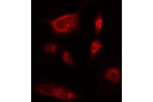 ABIN6274219 staining Hela cells by IF/ICC. (ITPKB 抗体  (Internal Region))