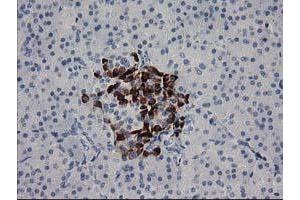 Immunohistochemical staining of paraffin-embedded Human pancreas tissue using anti-RGS5 mouse monoclonal antibody. (RGS5 抗体)