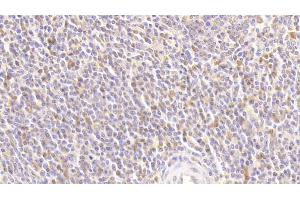 Detection of ATG16L1 in Human Spleen Tissue using Polyclonal Antibody to Autophagy Related Protein 16 Like Protein 1 (ATG16L1) (ATG16L1 抗体  (AA 1-284))