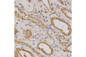 Immunohistochemistry (Paraffin-embedded Sections) (IHC (p)) image for anti-rho GTPase Activating Protein 25 (ARHGAP25) (AA 1-370) antibody (ABIN3021770)