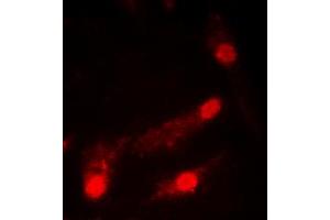 Immunofluorescent analysis of p53 (AcK386) staining in HeLa cells. (p53 抗体  (acLys386, C-Term))