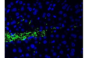 Immunofluorescence (fixed cells) (IF/ICC) image for anti-Cofilin 1 (CFL1) (pSer3) antibody (ABIN6255180)